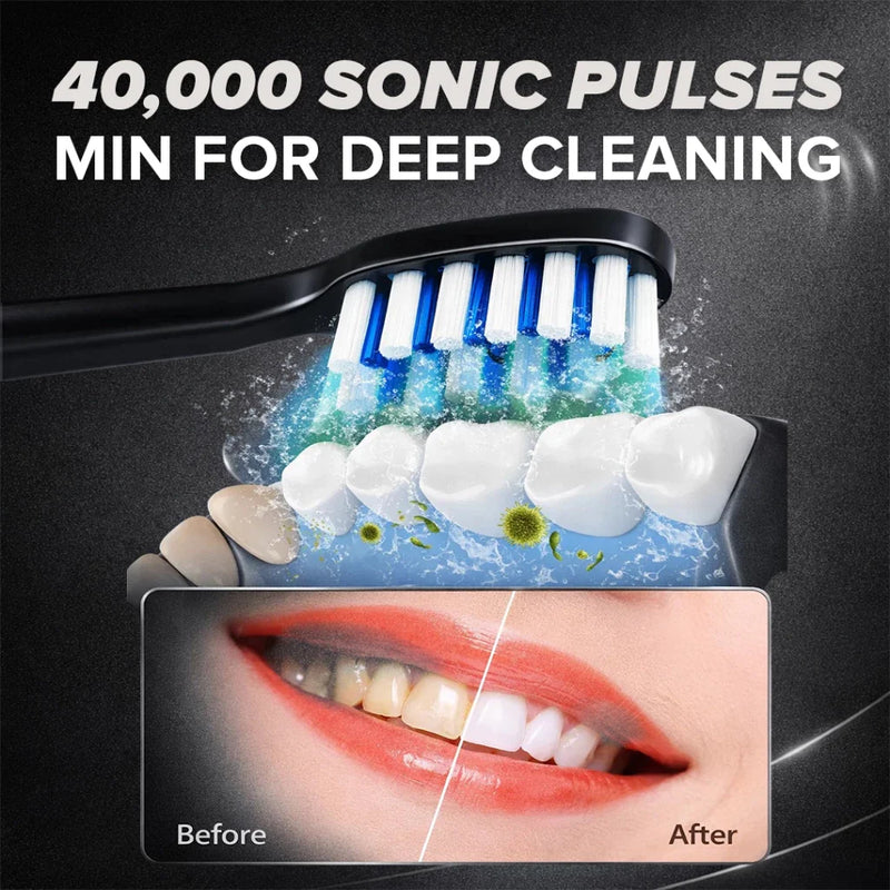 Cornell Sonic Electric Toothbrush with Pressure Sensor